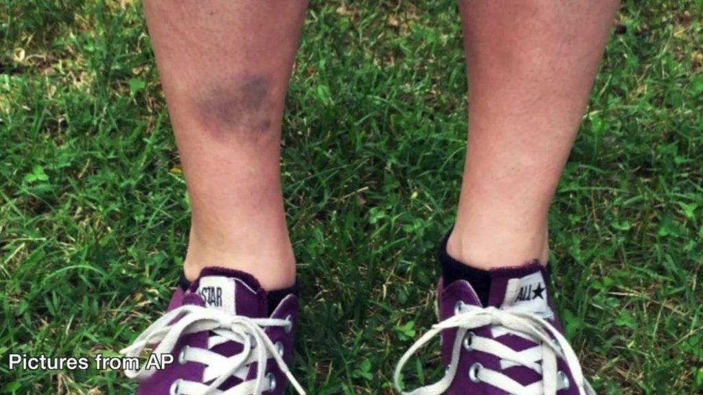 Safety concerns as Pokemon Go is released in the UK