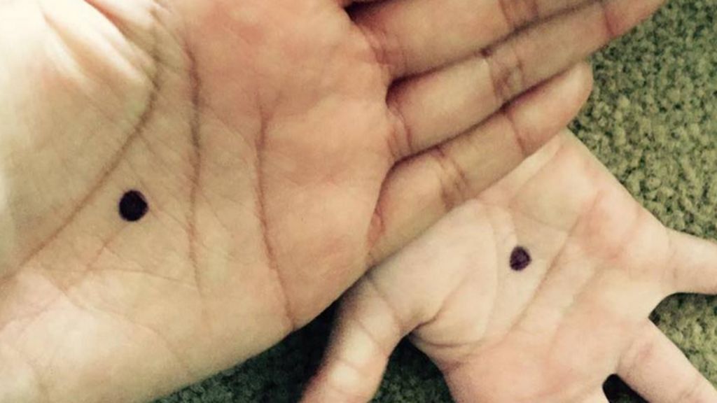 Can a Black Dot on a Victim's Hand Help Tackle Domestic Violence?