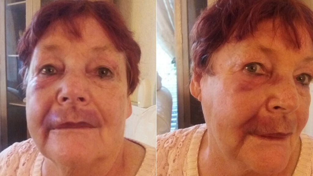 Woman, 73, attacked in Rochdale 'urinating' row