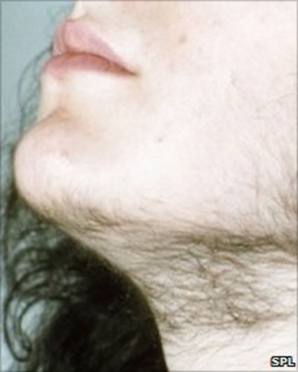 волосы на лице у женщин на груди фото 11