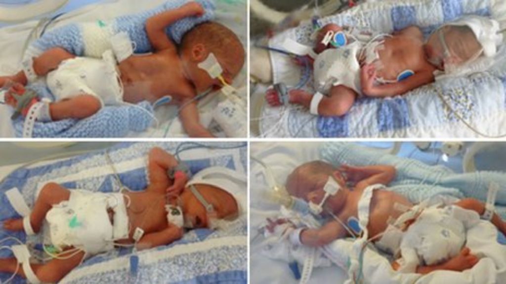 quadruplet-boys-born-in-bristol-on-leap-day-bbc-news