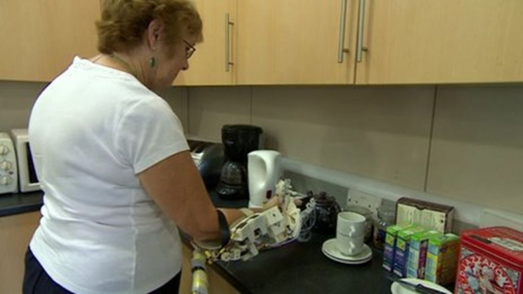 Robotic Exoskeleton Aids Hand Movement After Stroke Bbc News