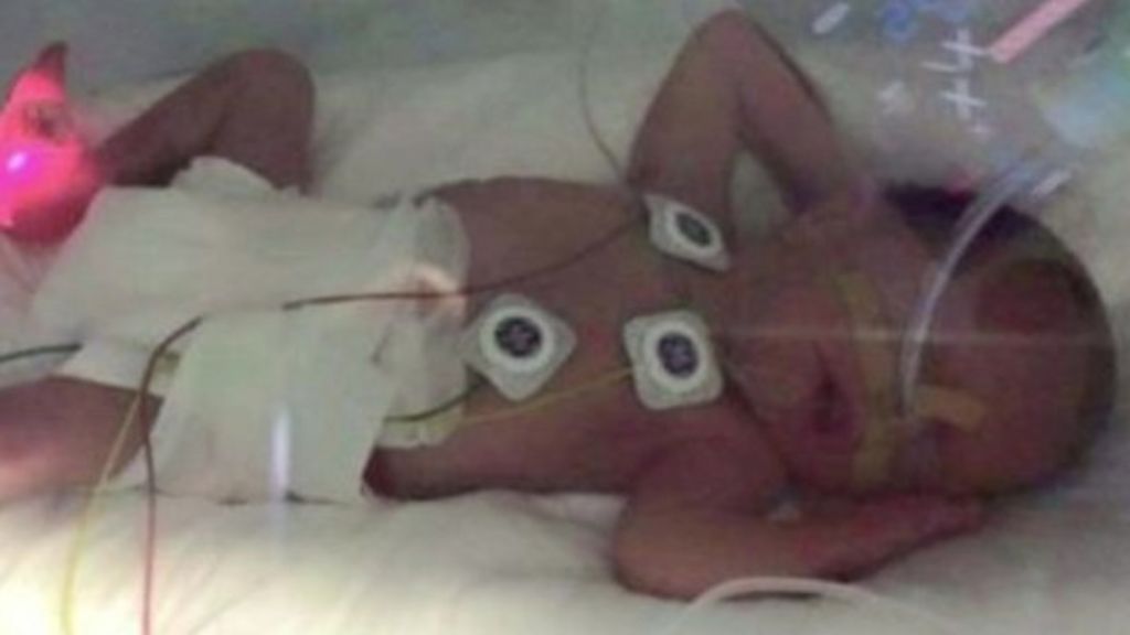 Premature baby couple stuck in Spain