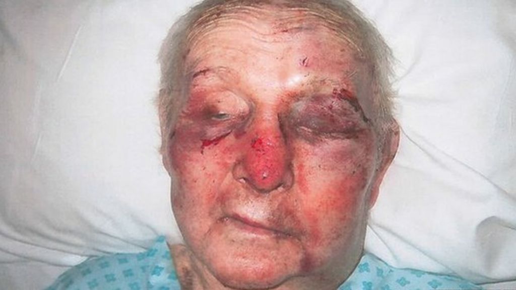 Man, 85, attacked by charity imposter
