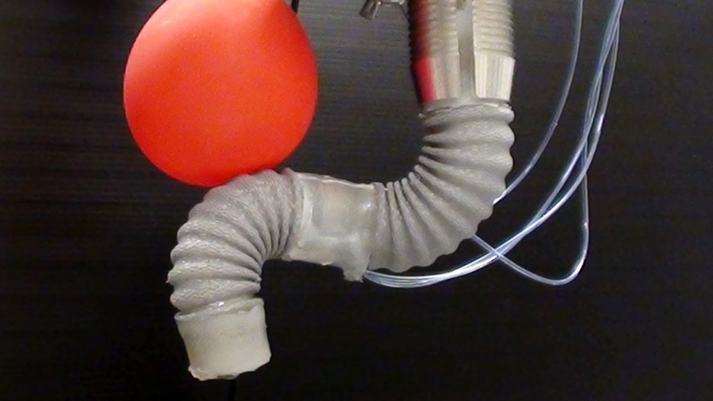 Robotic tentacle targets surgery