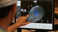 MRI scan