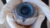 Giant eyeball
