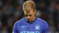 Man City's Joe Hart