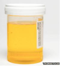 Urine sample