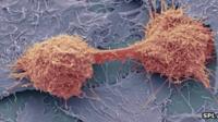 Cancer cells