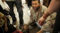 An Egyptian man sits beside his comrade, injured during clashes with security forces, 27th July