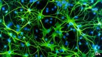 Neurons