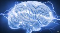 Brain