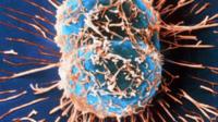 Cervical cancer cell