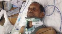 Sureshbhai Patel was seriously hurt and spent several days in hospital