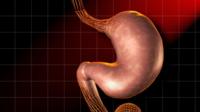 Stomach cancer can be detected late