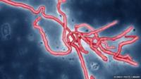 Ebola virus, viewed through an electron microscope