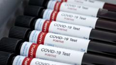 Tests de coronavirus cómo son las pruebas serológicas y moleculares