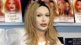 Pete Burns