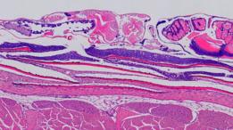Biopsia