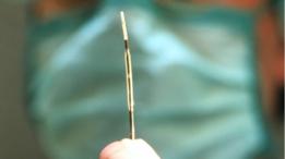 Stent intravascular