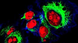 Células de Henrietta Lacks