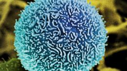 Célula de cáncer de páncreas.