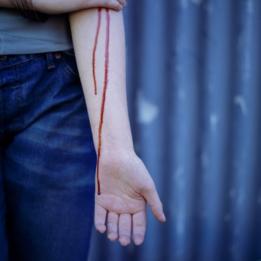 sangre corriendo por brazo de chica