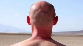 Head and shoulders of man from the back