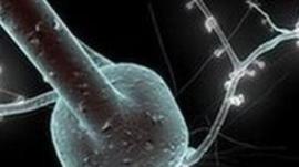 single neuron