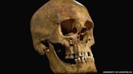 Skull of Richard III