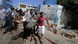 Palestinians carry a wounded man out of a UN-run school in Gaza after an Israeli attack in the area - 3 August 2014