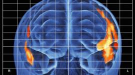 Scan showing brain activity while reading aloud.
