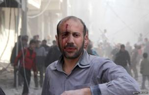 Barrel bomb victim
