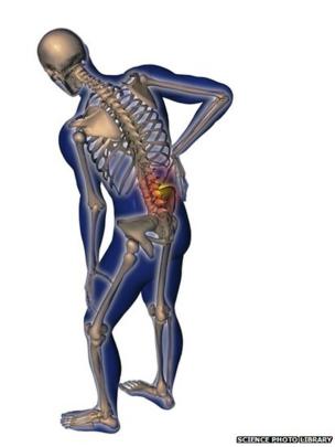 lower back pain in humans