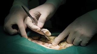 Close up as Thai veterinarians operate on Omsin at the Faculty of Veterinary Science, Chulalongkorn University, Bangkok, Thailand, 6 March 2017.