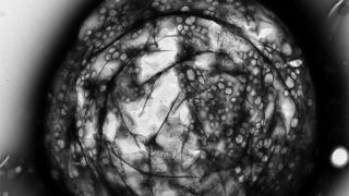A microbubble