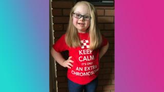 Alys wearing a T-shirt in support of WDSD.