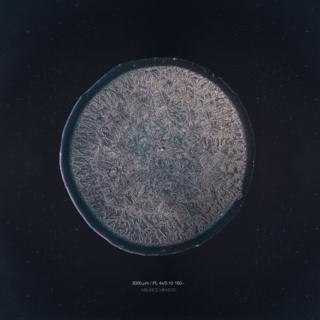 tear drops under microscope