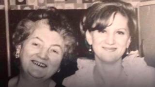 Kidney Transplant longevity
