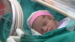Baby azra recovering in hospital