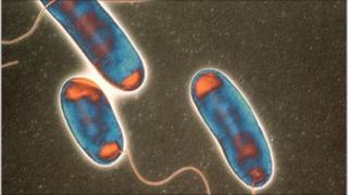Legionella bacteria