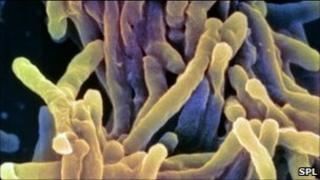 TB bacteria