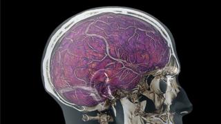 Brain