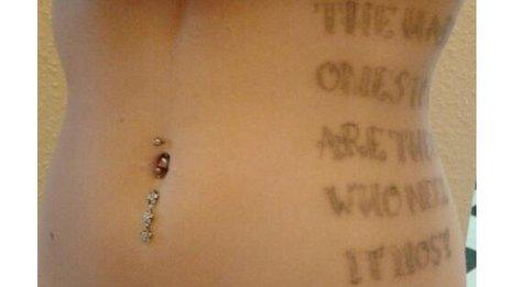 Louise has had 10 sessions of laser treatment to have her tattoo removed
