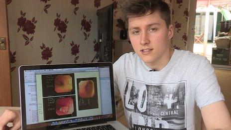 Psoriasis Sufferer Jessica Gough Let Down By Her Gp Bbc Newsbeat