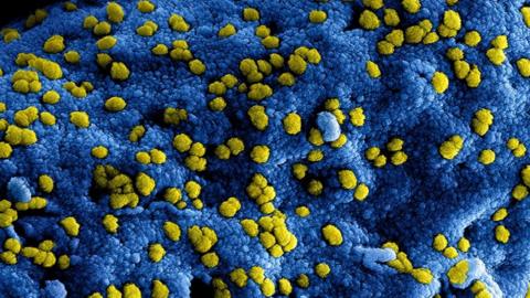 Coronavirus qué le hace el covid 19 a tu cuerpo BBC News Mundo