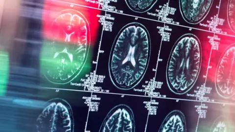 A human brain being scanned in a neurology clinic