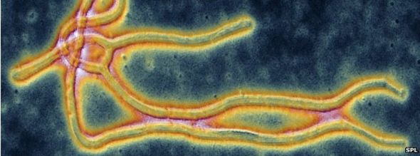 Ebola virus