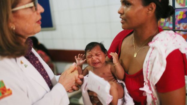 A mother holds her baby, who suffers from microcephaly